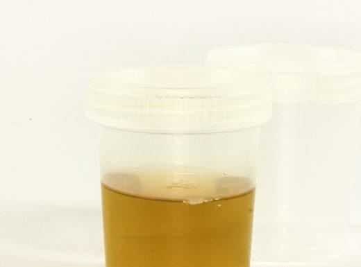 Madonna Immerses Herself in an Ice Bath and Drinks Her Urine to Heal Her Injuries Urine