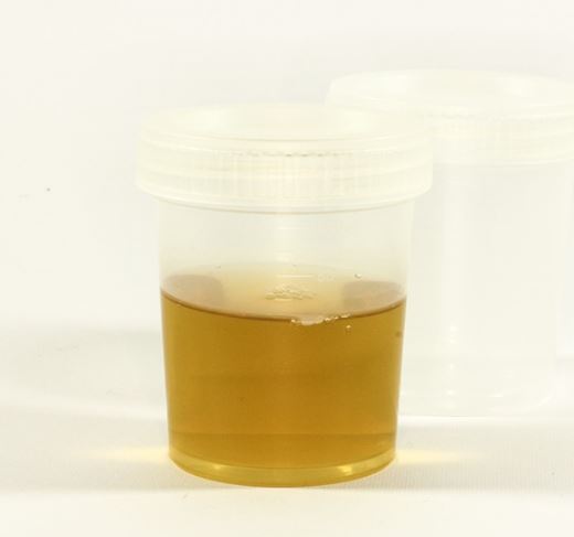 Urine